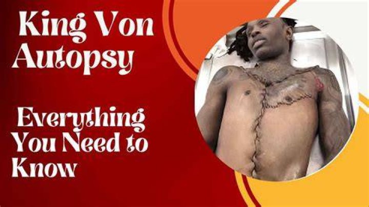 King Von Autopsy Photos: Unveiling the Truth Behind the Controversy